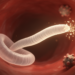 Heartworm Parasite May Leave Hidden Allergic Fingerprints in Humans, Study Suggests
