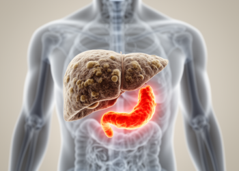 Chronic liver disease doubles the danger of acute pancreatitis, review finds