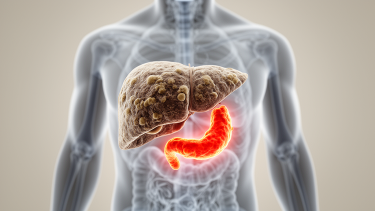 Chronic liver disease doubles the danger of acute pancreatitis, review finds