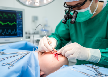 When Deep Brain Stimulation Fails in DYT-11: Revision Surgery and Smart Programming Rescue Three Patients