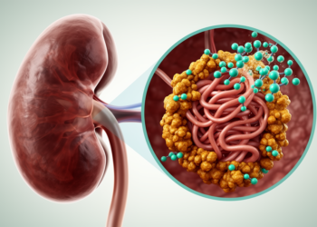 New Kidney Disease Therapies Strike at the Root of IgA Nephropathy