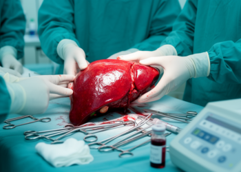Blood protein surge after liver reperfusion may flag early transplant graft failure
