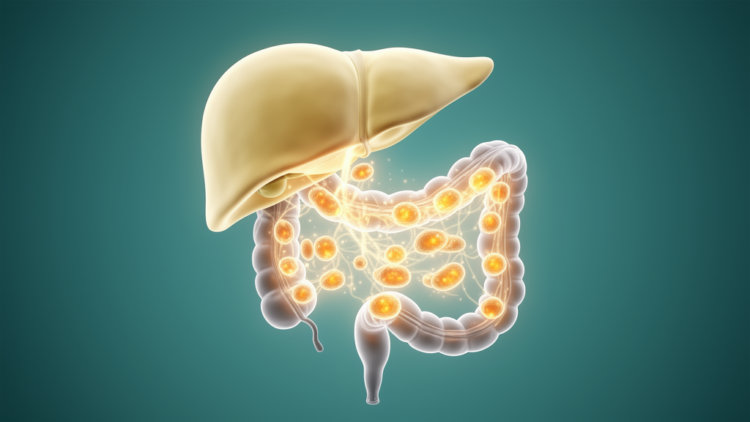 Fatty liver disease is not just a liver problem: how gut microbes, genes and metabolism collide