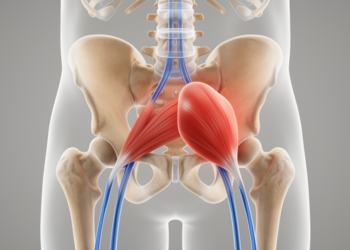 When Sciatica Isn’t From the Spine: A Case of Deep Gluteal Syndrome Linked to an Enlarged Piriformis Muscle