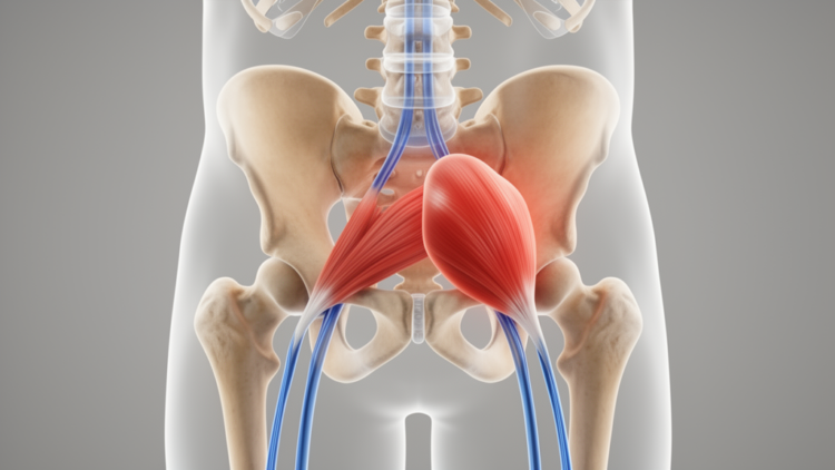 When Sciatica Isn’t From the Spine: A Case of Deep Gluteal Syndrome Linked to an Enlarged Piriformis Muscle