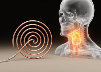 Design and optimization of a multi-band spiral antenna for frequency-dependent hyperthermia heating in head and neck cancer treatment