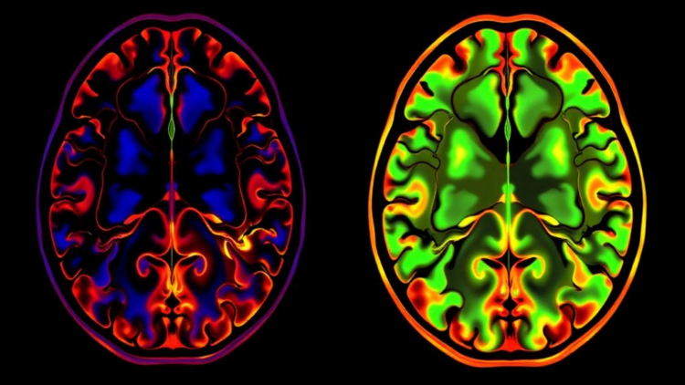 New Algorithm Reads Molecular Maps to Untangle Isotopic Patterns in Tissue Imaging