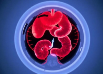 CZT Camera SPECT/CT Finds Hidden Gastrointestinal Bleeding That CT Misses