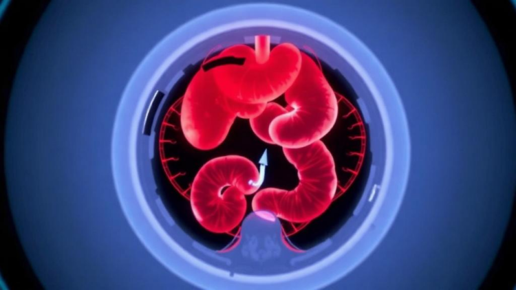 CZT Camera SPECT/CT Finds Hidden Gastrointestinal Bleeding That CT Misses