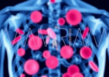New Nomogram Predicts Deadly Transplant Complication in High-Risk Leukemia Patients