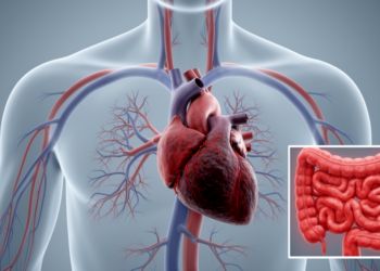 When Risk Factors Stack: Steroids, Colitis, and a Massive Pulmonary Embolism
