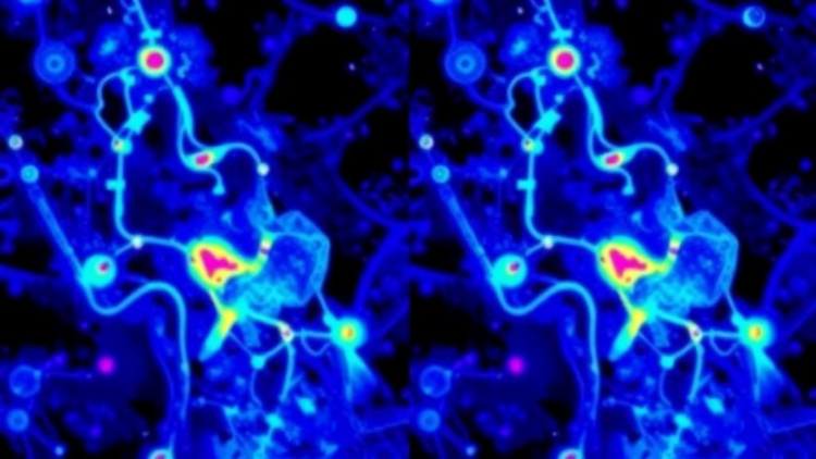 Raman Imaging Team Defends Label-Free Spectral Maps Against Criticism