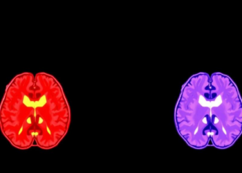 When Surgery Looks Better: The Hidden Bias in Motor Cortex Metastase Outcomes