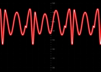 Inverted T-waves in Athletes Are Common but Usually Benign, Massive Analysis Finds