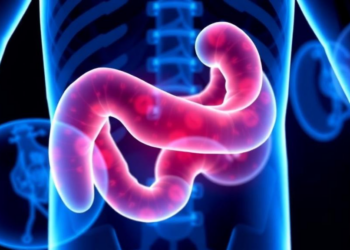 Real-World Data Show Total Neoadjuvant Therapy Boosts Tumor Response in Rectal Cancer