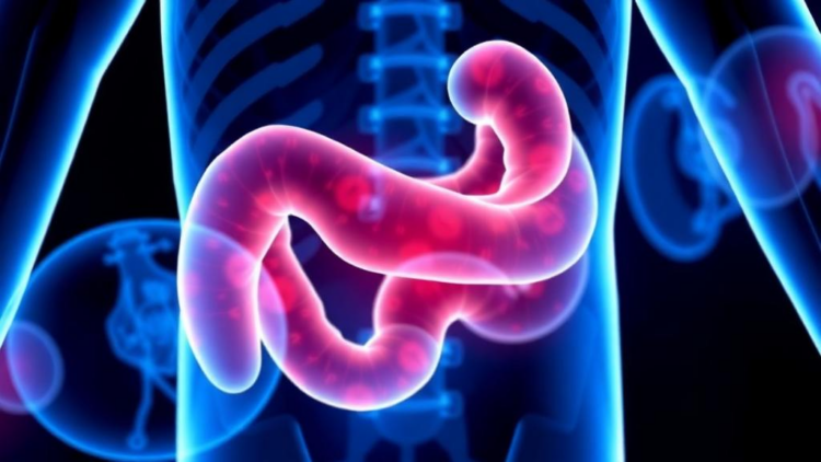 Real-World Data Show Total Neoadjuvant Therapy Boosts Tumor Response in Rectal Cancer
