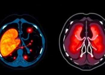 Dual-attention pyramid AI sharpens liver tumor detection on CT scans