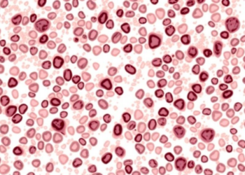 Old-Fashioned Mitotic Count May Outperform Ki67 in Hormone Receptor-Positive Breast Cancer