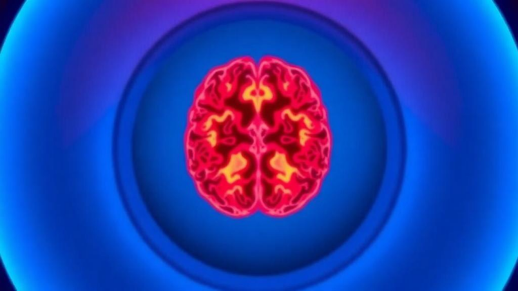 AI Reads Brain Scans to Predict Cognitive Test Performance with 7-Tesla MRI