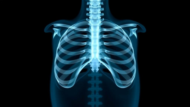 Older Women and Recurrent TB Face Higher Risk of Bone and Joint Tuberculosis, Study Finds