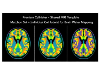 Shared MRI Template Matches Individual Coil Calibration for Brain Water Mapping