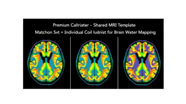 Shared MRI Template Matches Individual Coil Calibration for Brain Water Mapping