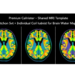 Shared MRI Template Matches Individual Coil Calibration for Brain Water Mapping