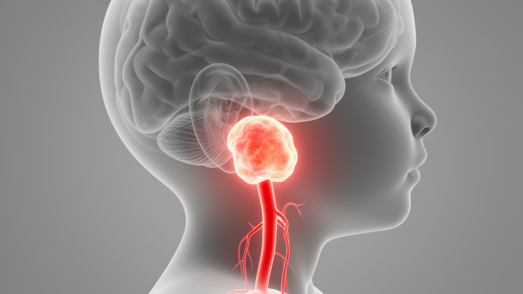 When a Neck Abscess Is Actually a Blood Vessel: Rare Arterial Danger Unmasked in a Child
