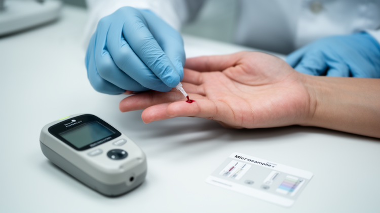 Finger-prick blood test for Alzheimer’s biomarkers works for some proteins but fails on pTau217