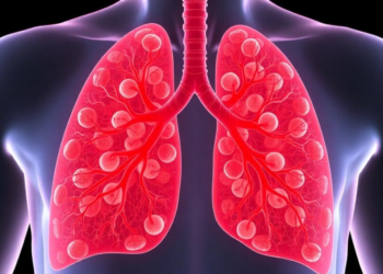 Macrophage Exosomes Carry a MicroRNA That Drives Scarring in the Lung, Study Finds