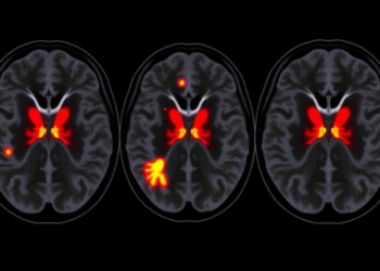 Time-Dependent Diffusion MRI Reveals Hidden Microstructure of Childhood Sarcomas
