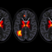 Time-Dependent Diffusion MRI Reveals Hidden Microstructure of Childhood Sarcomas