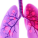 Seven Tiny RNAs Emerge as Potential Keys to Aggressive Lung Cancer Survival