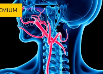 Carotid Geometry Links to Stenosis and Disturbed Blood Flow