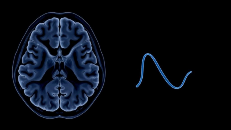 Novel CTNNB1 missense variant identified in child with spastic diplegia and visual defects