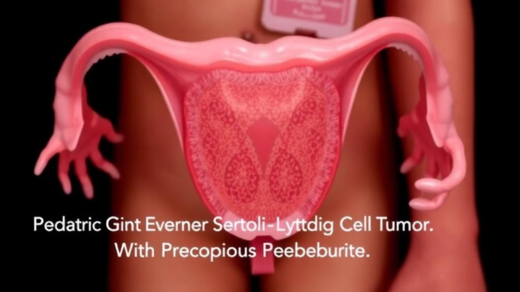 Case Report: Pediatric Giant Ovarian Sertoli–Leydig Cell Tumor With Precocious Puberty