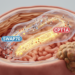 SWAP70 promotes liver cancer growth through CPT1A-dependent fatty acid oxidation
