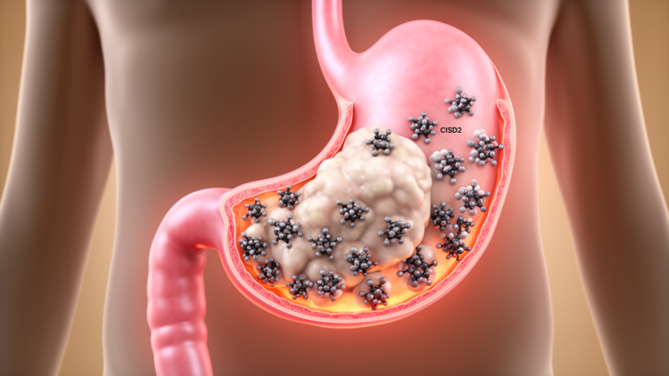 Association between CISD2 expression and clinicopathological features and prognosis in gastric cancer: a systematic review, meta-analysis, and database validation