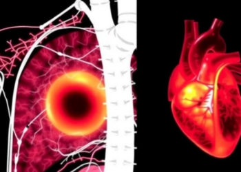 Single-Cell Atlas Reveals How the Metabolic Enzyme PDK4 Drives Scarring After Heart Attack