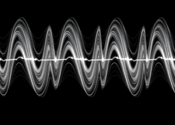 Shear wave elastography tracks earlier exercise responses in type 2 diabetes