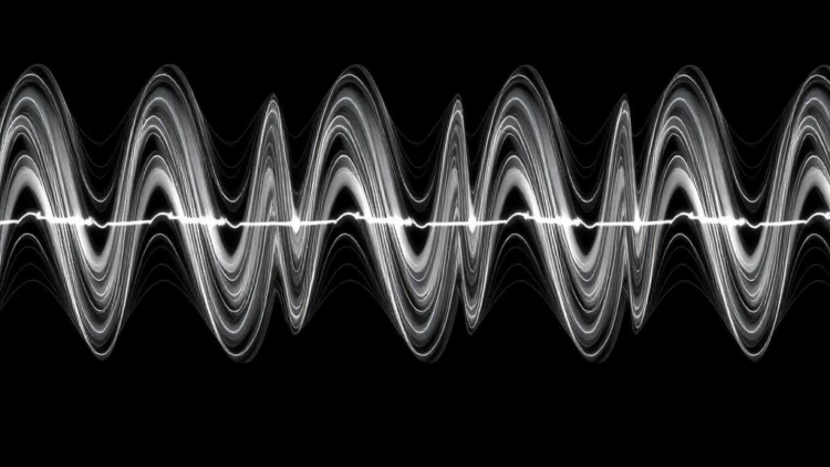 Shear wave elastography tracks earlier exercise responses in type 2 diabetes
