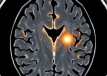 Explainable AI Spots Brain Tumors on MRI Scans in Milliseconds