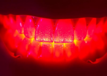 Laser Speckle Imaging and AI Predict the Strength of Dental Fillings Without Breaking Them