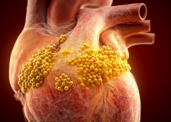 Golden Staph Drives Deadly Heart Valve Infections in Children, Beijing Study Finds