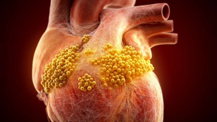 Golden Staph Drives Deadly Heart Valve Infections in Children, Beijing Study Finds