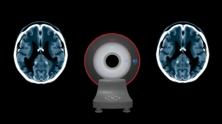 Ultra-Powerful 7-Tesla MRI Outperforms CT Scans in Measuring Brain Artery Narrowing