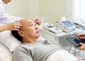 Trial will test timing of acupuncture and vagus nerve stimulation after stroke