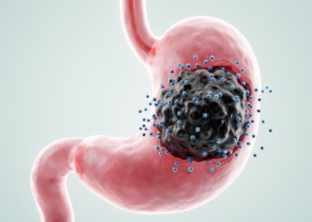 Early Tumor Shrinkage Predicts Longer Survival in Gastric Cancer Patients on Immunotherapy
