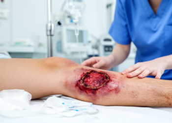 Flesh-Eating Wound Infection Linked to Suspected Toxic Drug Adulterant in Young Patient