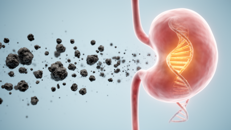 Air Pollution May Dramatically Raise Bladder Cancer Risk, Especially in the Genetically Vulnerable